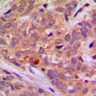 CPA3329-100ul - STK11