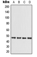 CPA3329-100ul - STK11