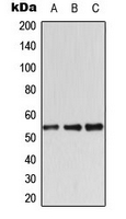 CPA3330-100ul - STK11