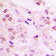 CPA3333-100ul - TCEB3