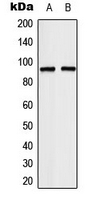 CPA3333-100ul - TCEB3