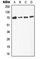 CPA3336-100ul - TGFBR2