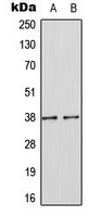 CPA3359-100ul - SOCS1