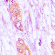 CPA3373-100ul - MELK