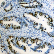 CPA3374-100ul - ZFHX1B
