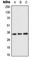 CPA3376-100ul - ACOT8