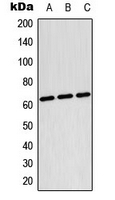 CPA3380-100ul - TESK2