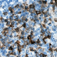 CPA3412-100ul - CDKL3