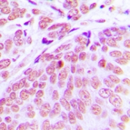 CPA3442-100ul - CEP70