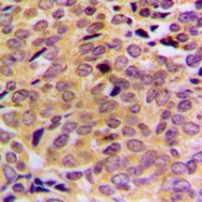 CPA3461-100ul - MRPL21