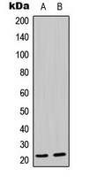 CPA3461-100ul - MRPL21