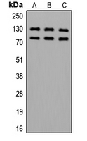 CPA3470-100ul - Alpha-adducin