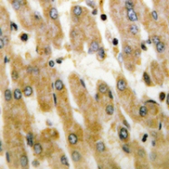 CPA3476-100ul - DUSP1/4