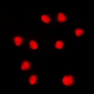 CPA3482-100ul - FOXC1/2