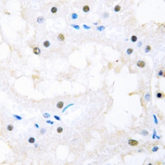 CPA3482-100ul - FOXC1/2
