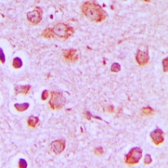 CPA3495-100ul - Synaptotagmin