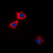 CPA3496-100ul - CaMK2 alpha/delta