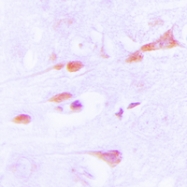 CPA3496-100ul - CaMK2 alpha/delta