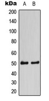 CPA3496-100ul - CaMK2 alpha/delta