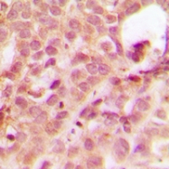 CPA3499-100ul - ABL1