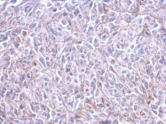 GTX100187 - Histamine H3 receptor