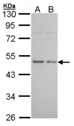 GTX100187 - Histamine H3 receptor