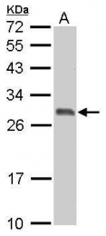 GTX100289 - 14-3-3 protein sigma / SFN