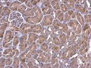 GTX100453 - Insulin-like growth factor II / IGF2