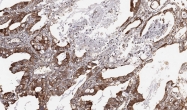 GTX100589 - Heparanase-2 / HPA2