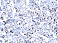 GTX100634 - Estrogen receptor alpha