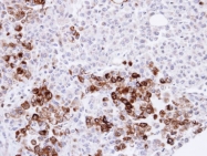 GTX101147 - Heme oxygenase 1 / HMOX1