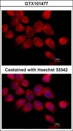 GTX101477 - Transketolase (TKT)