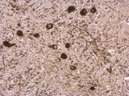 GTX101586 - Tryptophan 5-hydroxylase 1 (TPH1)