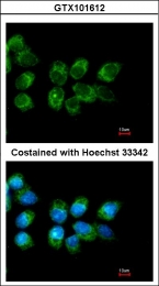 GTX101612 - Folate receptor alpha