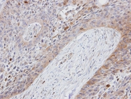 GTX101612 - Folate receptor alpha