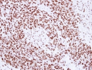 GTX101664 - U1 snRNP protein A