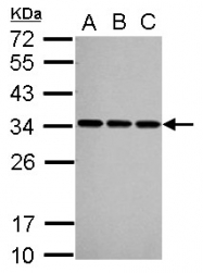 GTX101664 - U1 snRNP protein A