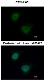 GTX101852 - hnRNP-A/B / HNRNPAB