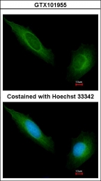 GTX101955 - Tyrosine-protein kinase JAK1