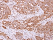 GTX102199 - 14-3-3 protein theta