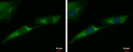 GTX102424 - Tyrosine 3-monooxygenase (TH)