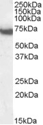 GTX10261 - DDX5