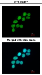 GTX103197 - DNA ligase 3