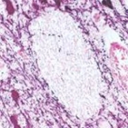 GTX10372 - Tyrosine 3-monooxygenase (TH)