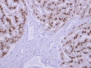 GTX103896 - Tripeptidyl-peptidase 1 (TPP1)
