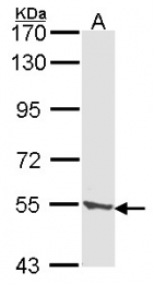 GTX103896 - Tripeptidyl-peptidase 1 (TPP1)