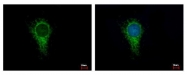 GTX104073 - Isocitric dehydrogenase alpha / IDH3A