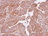 GTX104073 - Isocitric dehydrogenase alpha / IDH3A
