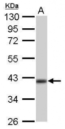 GTX104073 - Isocitric dehydrogenase alpha / IDH3A