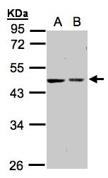 GTX104594 - Galactokinase 2